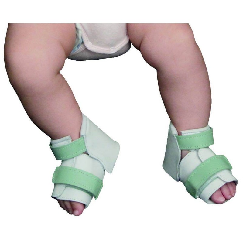 Orteza pediatryczna, korekta wrodzonej deformacji stóp